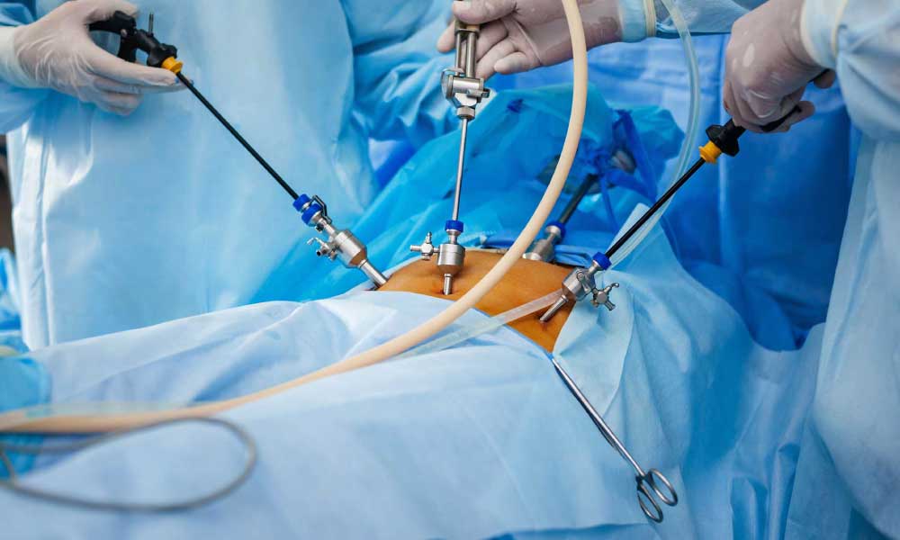 Miracle Of Laparoscopic Surgery And It’s Benefits